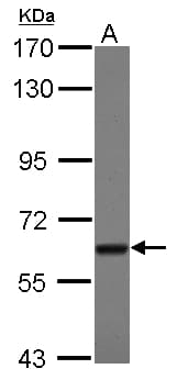 TBRG4 Antibody