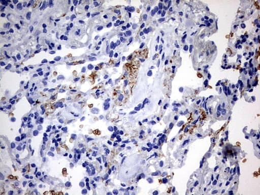 Monoclonal Mouse anti-Human ALDP / ABCD1 Antibody (clone OTI2C12, aa508-745, IHC, WB)