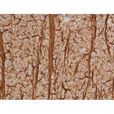 SP1 Antibody (phospho-Thr453)
