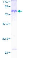 Human NDRG1 Protein (Recombinant GST)