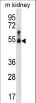 Polyclonal Rabbit anti-Mouse STK32B Antibody (aa315-343, IHC, WB)