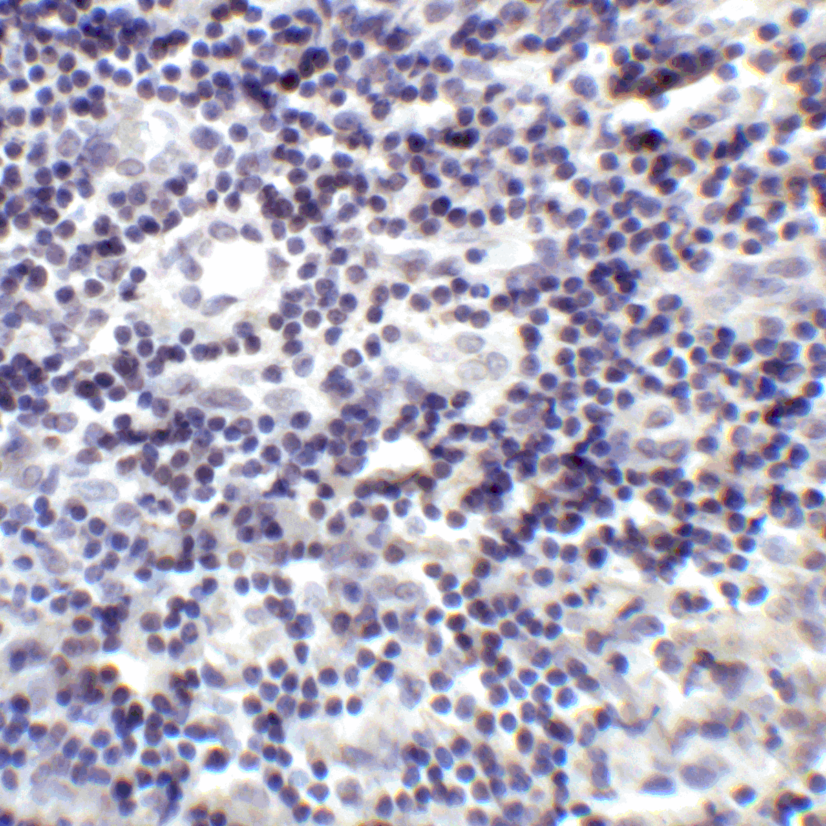 IHC-plus™ PD-L2 / PDCD1LG2 / CD273 Antibody (clone 4E10)