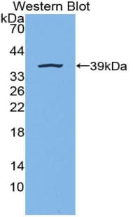 LIG1 / DNA Ligase 1 Antibody (aa568-875, Biotin)
