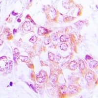 Polyclonal Rabbit anti-Human RPS6KB1 / P70S6K / S6K Antibody (Internal, IHC, IF, WB)