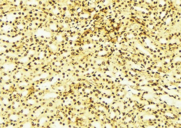 SNCA / Alpha-Synuclein Antibody