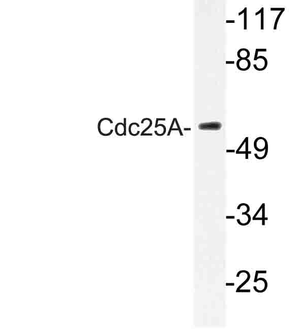 Polyclonal Rabbit anti-Human CDC25A Antibody (Asn70, WB)
