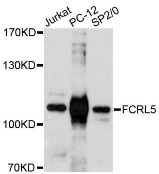 Polyclonal Rabbit anti-Human FCRL5 / CD307 Antibody (WB)
