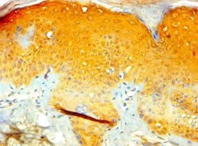 TIAF1 Antibody (aa1-115)