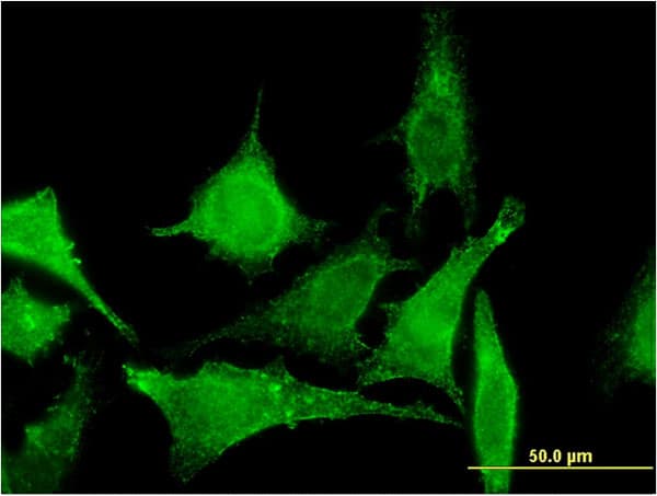 Monoclonal Mouse anti-Human TBCC Antibody (clone 3D3, IF, WB)