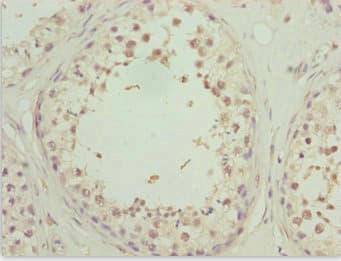 ZNF20 Antibody