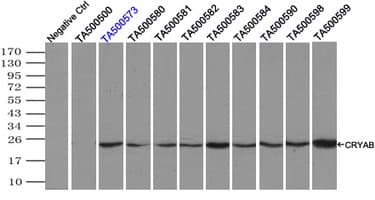 CRYAB / Alpha B Crystallin Antibody (clone OTI3C2)
