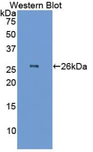 GSTA1 Antibody (aa2-222)