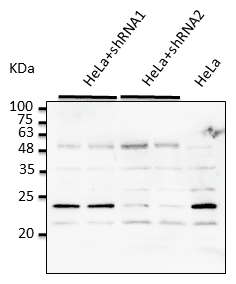 IHC-plus™ RAB7A / RAB7 Antibody (C-Terminus)