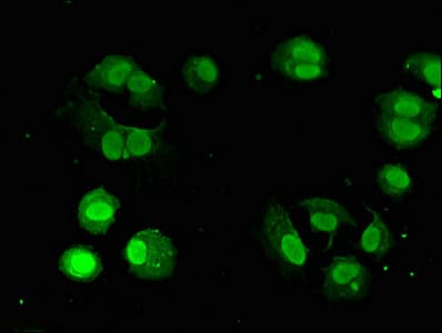 Polyclonal Rabbit anti-Human GNAQ Antibody (IHC, IF)