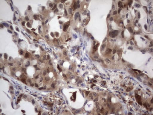 LGALS3 / Galectin 3 Antibody (clone OTI8D7)