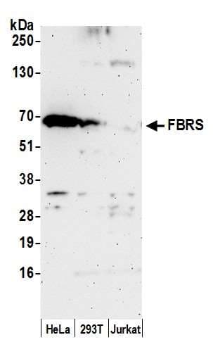 FBS1 Antibody (aa1-50)