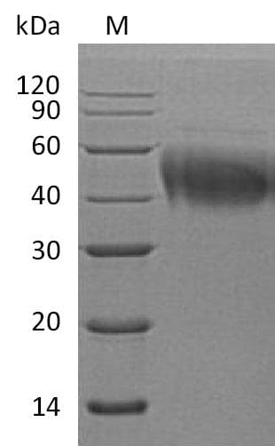 Human IL4R / CD124 Protein (Recombinant 6His, C-terminus)