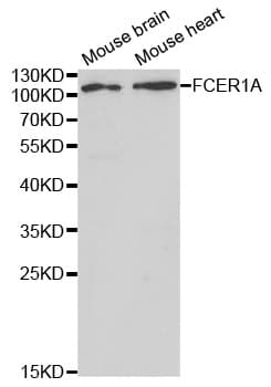 Polyclonal Rabbit anti-Human FcERI / Fc Epsilon RI Antibody (WB)
