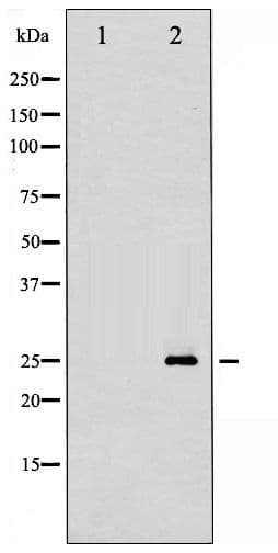 CDKN1B / p27 Kip1 Antibody (phospho-Ser10)