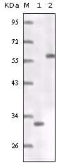 ER Alpha / Estrogen Receptor Antibody (clone 5D4B1)
