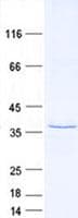 Human TAMM41 / C3orf31 Protein (Recombinant His, N-Terminal)