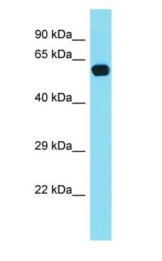 POLA2 / DNA Polymerase Alpha 2 Antibody (aa151-200)