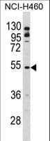 BLNK Antibody (aa150-178)