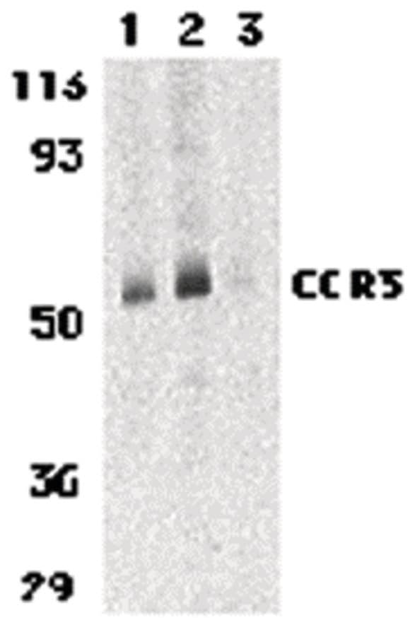 Polyclonal Rabbit anti-Human CCR3 Antibody (IHC, IF, WB)
