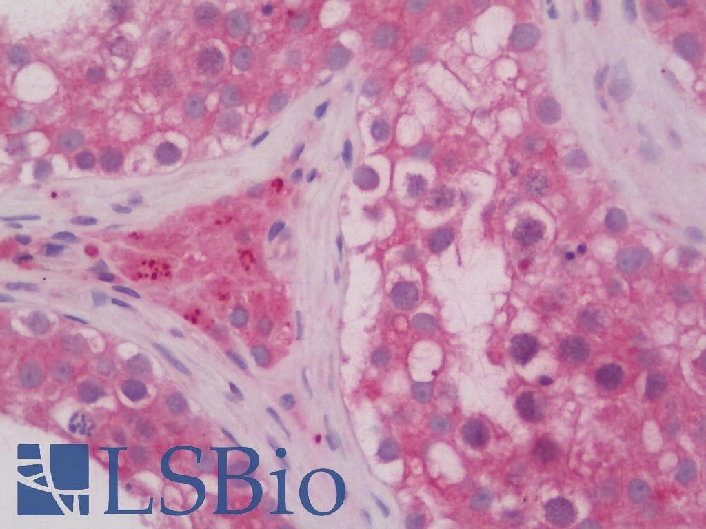 PathPlus™ RAB5A / RAB5 Antibody (C-Terminus)