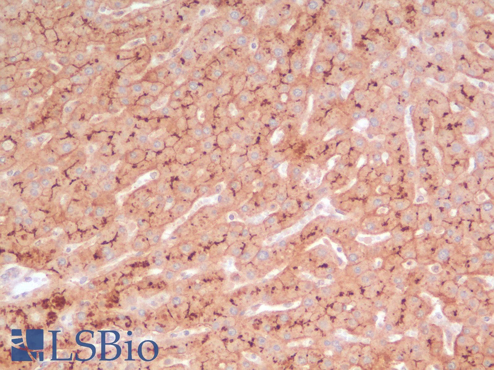 IHC-plus™ ABCB11 / BSEP Antibody (Concentrated)