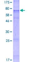 Human DIRC2 / RCC4 Protein (Recombinant GST)