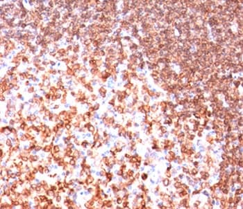 CD74 / CLIP Antibody (clone LN-2, Ready-to-Use)