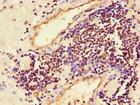 MAPK8 / JNK1 Antibody