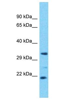 OR4D6 Antibody (aa258-307)
