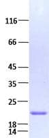 Human FGF7 / KGF Protein (Recombinant)