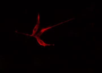 PKP2 / Plakophilin 2 Antibody