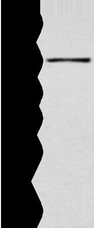 Polyclonal Rabbit anti-Human SMARCA1 / SWI Antibody (IHC, WB)
