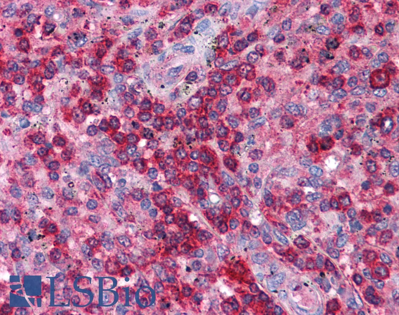 SNF8 / EAP30 Antibody (N-Terminus)