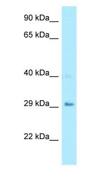 CA7 / Carbonic Anhydrase VII Antibody (aa90-139)