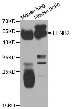 EFNB2 / Ephrin B2 Antibody
