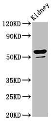 CYP8B1 Antibody
