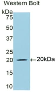 LF / LTF / Lactoferrin Antibody (aa542-685)
