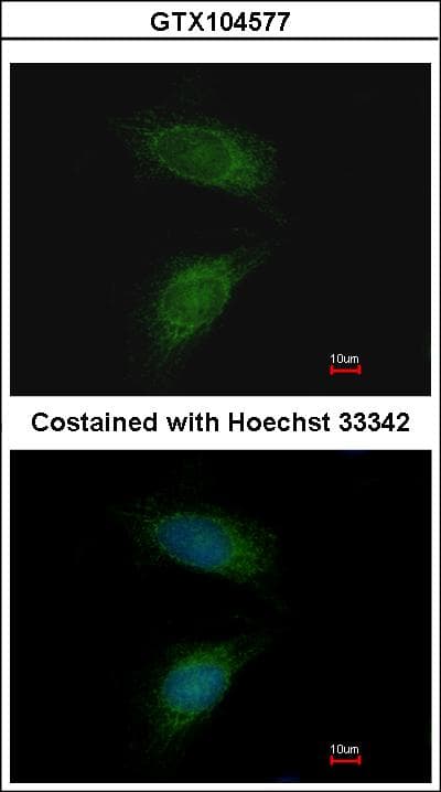 MMP2 Antibody (aa193-575)