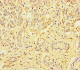 ZSCAN29 Antibody