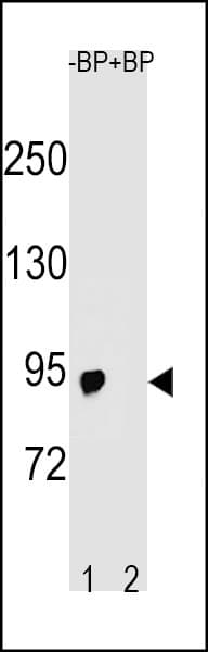 IHC-plus™ SLCO6A1 / OATP-I Antibody (aa678-707)