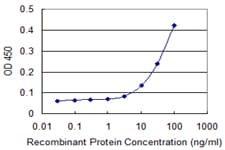 IHC-plus™ NPRB / NPR2 Antibody (clone 1E4)