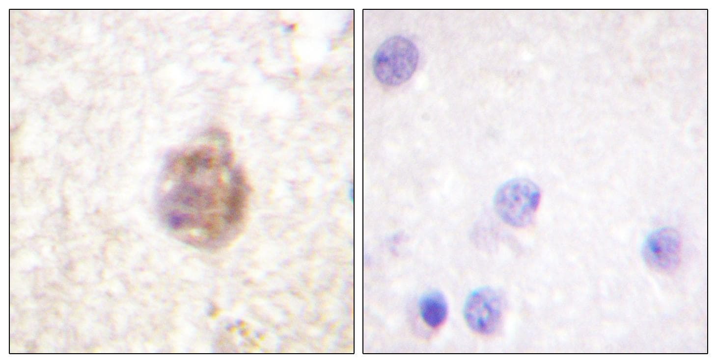 Polyclonal Rabbit anti-Human IRS1 Antibody (phospho-Ser794, IHC)