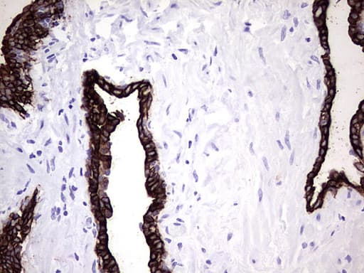 KRT7 / CK7 / Cytokeratin 7 Antibody (aa1-114, clone UMAB161, Carrier-free)