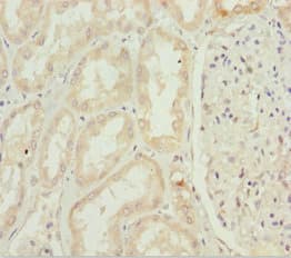 Polyclonal Rabbit anti-Human INPP5K / SKIP Antibody (IHC, WB)