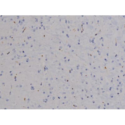 STAT6 Antibody (phospho-Thr645)